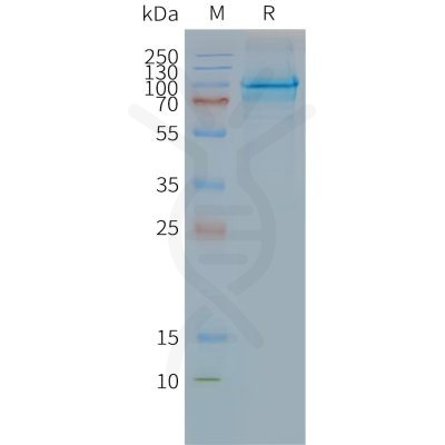 page-FLP100110 CLPTM1 Fig.2 SDS PAGE 1
