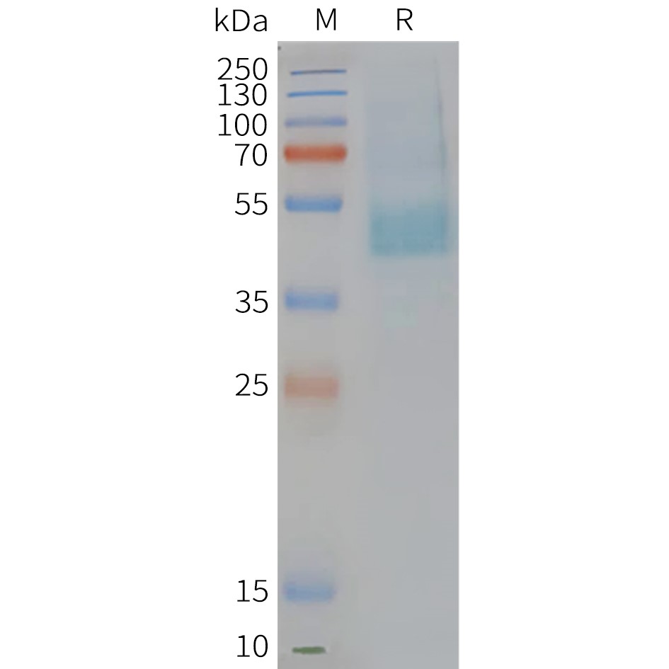 FLP100126-CMKLR1-Fig.2-SDS-PAGE-1.jpg