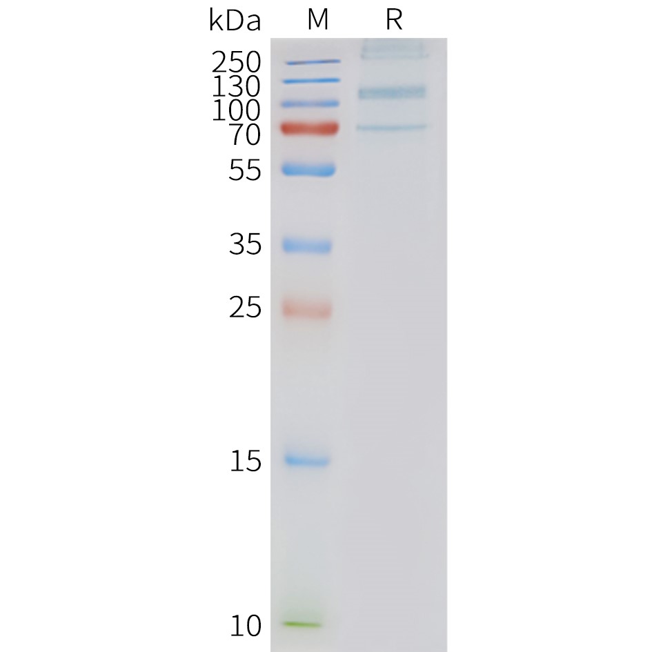 FLP100127-ADGRD1-Fig.2-SDS-PAGE-1.jpg