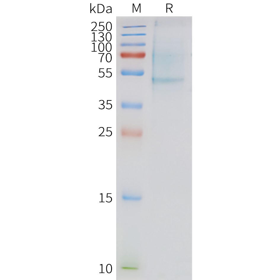 FLP100132-APLNR-Fig.2-SDS-PAGE-1.jpg