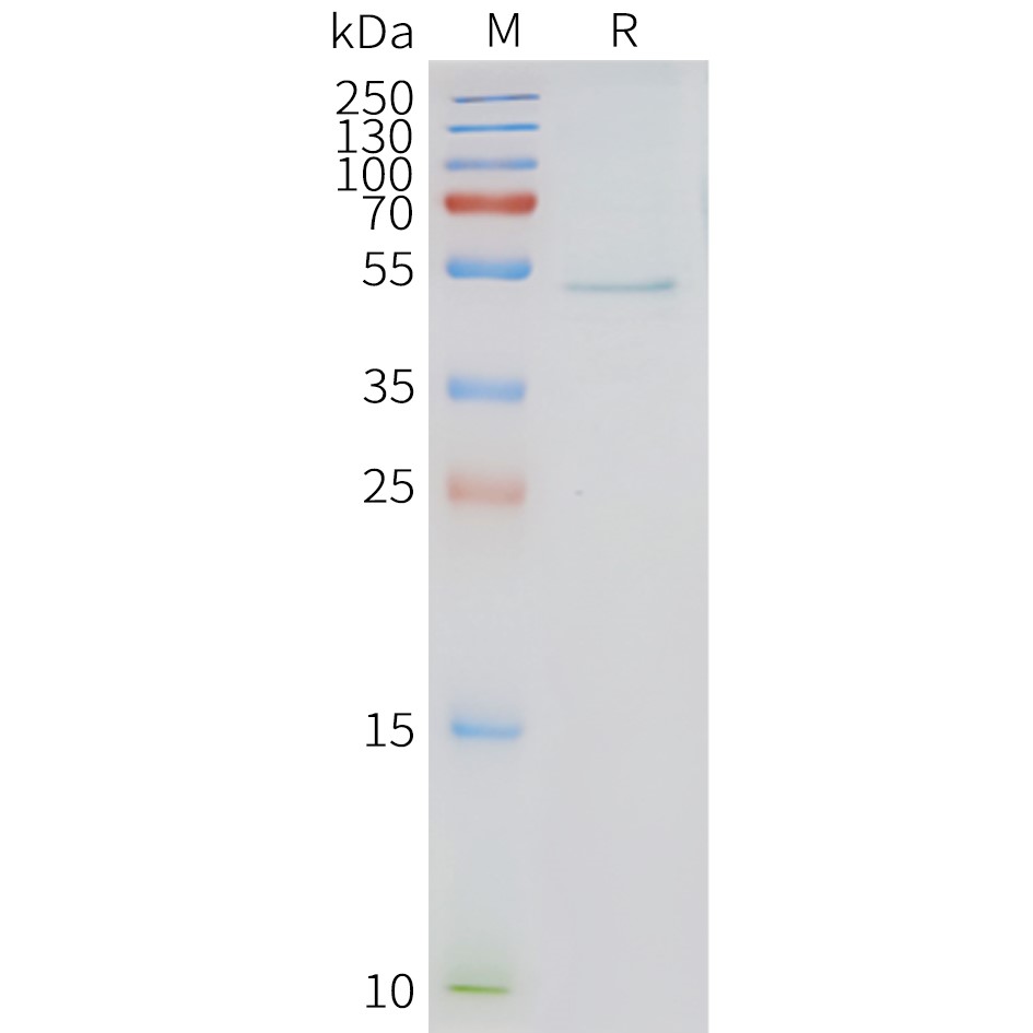 FLP100133-HRH3-Fig.2-SDS-PAGE-1.jpg