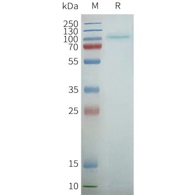 page-FLP100155 TAS1R2 Fig.2 SDS PAGE 1