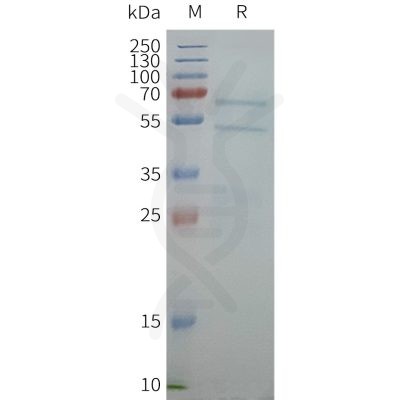 page-FLP100156 ABCG1 Fig.2 SDS PAGE 1