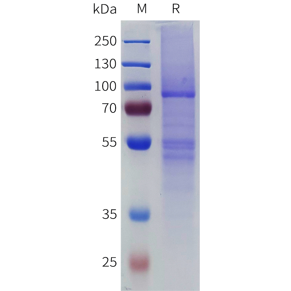 flp-m100500b-il10ra-sp1.jpg