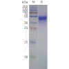 page-flp m120094 ccr1 strep sp1