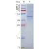 page-flp100062 gpr87 sp1