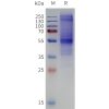 page-flp100095b cxcr7 sp1