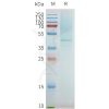 page-flp100096 ptger2 sp1
