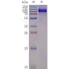 page-flp100128 trpv1 sp1