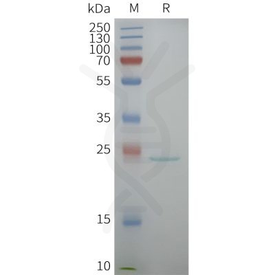 page-flp100158 aqp5 sp1