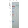 page-flp100159 trpv6 sp1