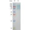 page-flp100308 gpr39 sp1