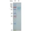 page-flp100359 nk1r sp1