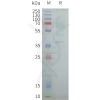 page-flp100429 oxyr sp1
