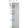 page-flp110031 gpr75 sp1