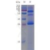page-flp120014 cldn18.2 strep sp1