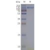 page-flp120033 trpa1 strep sp1