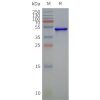 page-flp120043 steap2 strep sp1