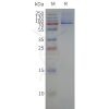 page-flp120047 fshr strep sp1