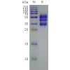 page-flp120069 c5ar2 strep sp1