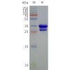 page-flp120070 steap1 strep sp1