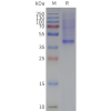 page-flp120122 mc4r strep sp1