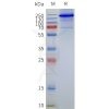 page-flp120128a mbp trpv1 strep sp1