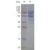 page-flp120161 5ht1a strep sp1