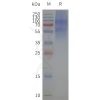 page-flp120168 5ht2c strep sp1