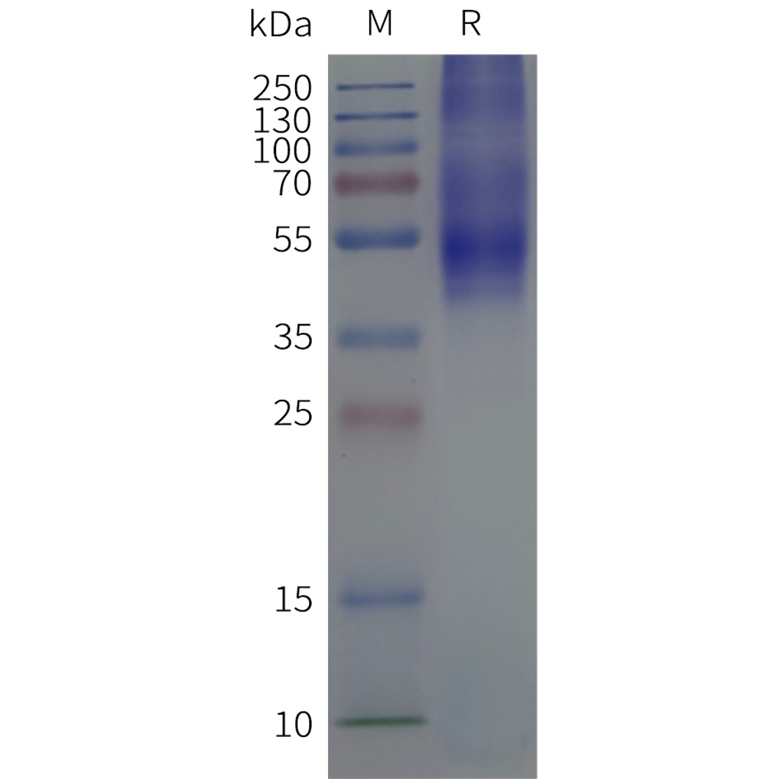 flp120169-5ht4r-strep-sp1.png
