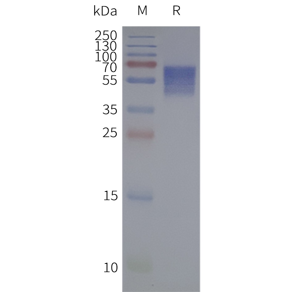 flp120171-5ht6r-strep-sp1.jpg
