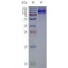 page-flp120179 chrm3 strep sp1