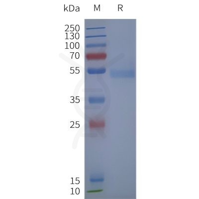 page-flp120189 adrb2 strep sp1