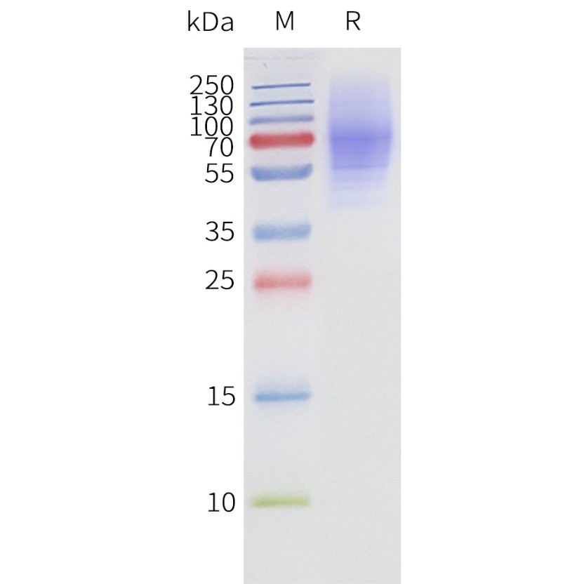 flp120190-adrb3-strep-sp1.jpg