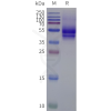 page-flp120235 ednrb strep sp1