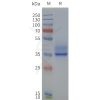 page-flp120236 ffar2 strep sp1