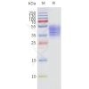page-flp120237 ffar3 strep sp1 1