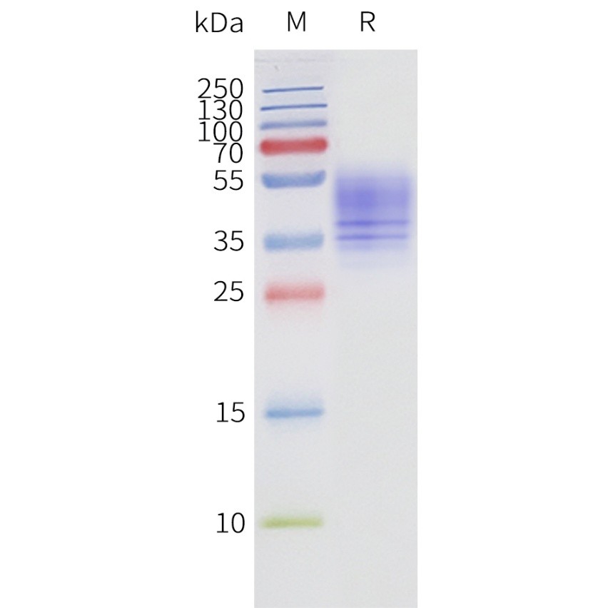 flp120237-ffar3-strep-sp1.jpg