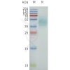 page-flp120238 ffar4 sp1
