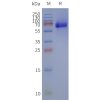 page-flp120242 fzd1 strep sp1