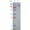 page-flp120246 fzd6 strep sp1