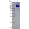 page-flp120251 gabr1 strep sp1