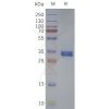 page-flp120261 gpr119 strep sp1