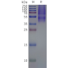 page-flp120296 gpr19 strep sp1