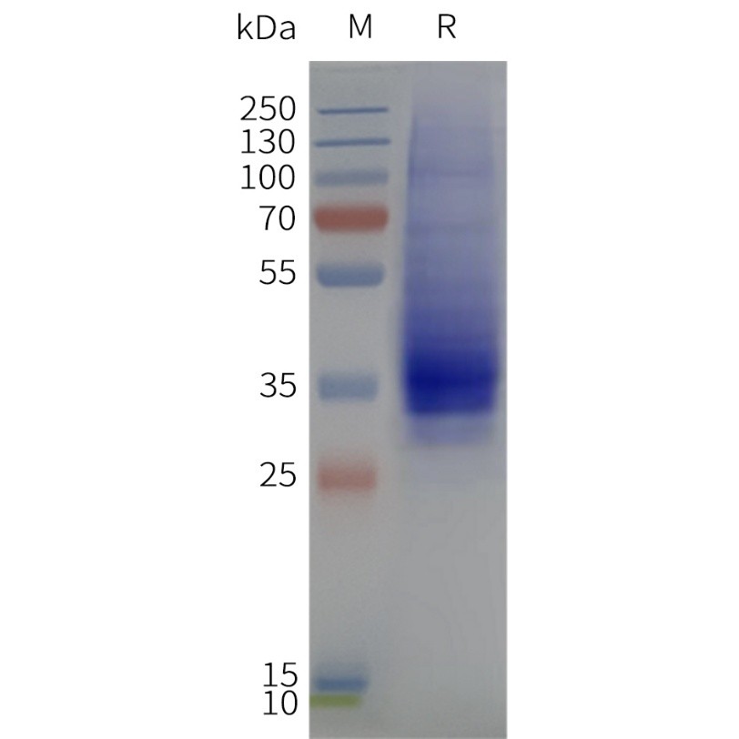 flp120306-gpr35-strep-sp1.jpg