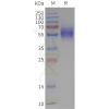page-flp120307 gpr37 strep sp1