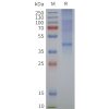 page-flp120309 gpr4 strep sp1