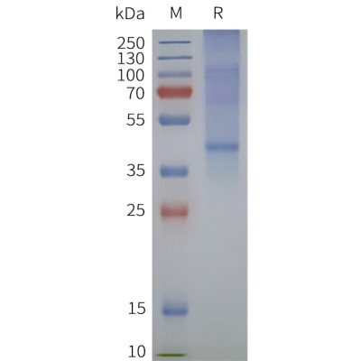 page-flp120309 gpr4 strep sp1