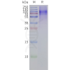 page-flp120311 gpr45 strep sp1