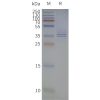 page-flp120321 gpr88 strep sp1